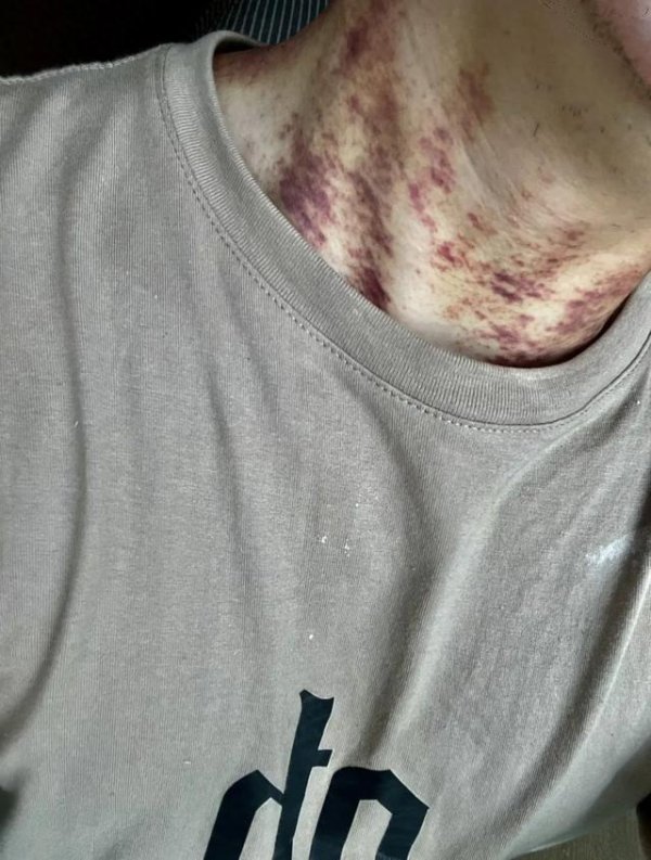 扬帆优配 男子称住进月租6万“甲醛房”患病，房东：他搬进不少家具，租客：连被褥4件套都是他配的，将邀请机构复检